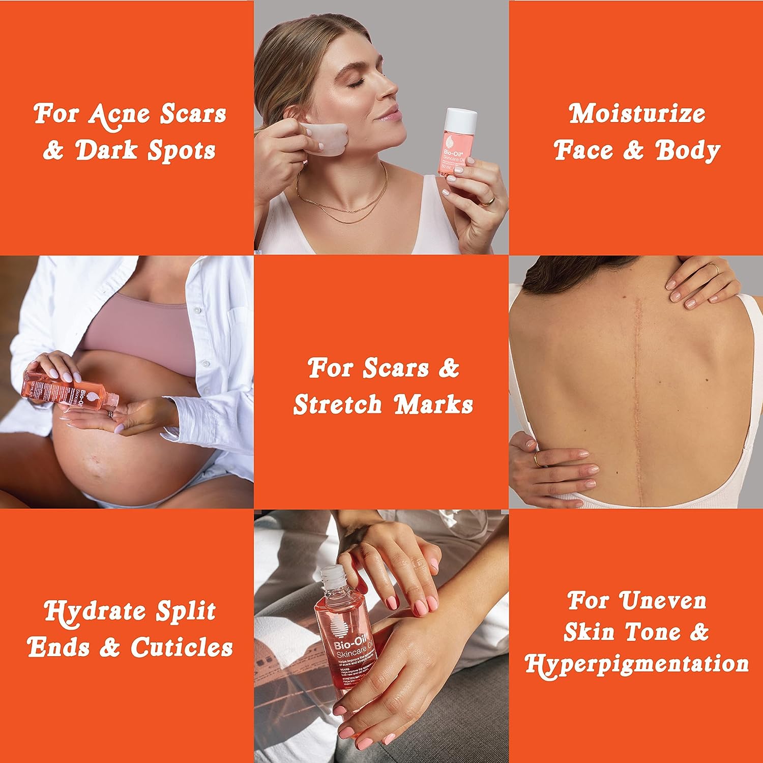 Bio-Oil Skincare Body Oil, Serum for Scars and Stretchmarks, Face and Body Moisturizer Dry Skin, Non-Greasy, Dermatologist Recommended, Non-Comedogenic, For All Skin Types, with Vitamin A, E, 4.2 oz